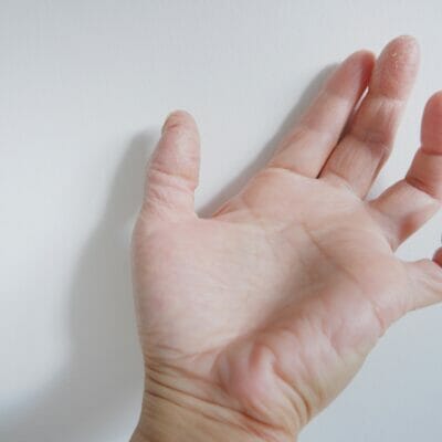 ばね指(弾発指)は自力で治せる？原因と療法の解説 | 山室クリニック